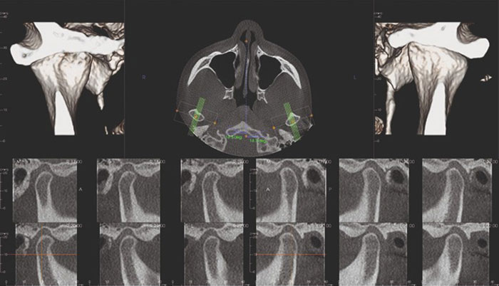 顎関節の診断精度も向上します